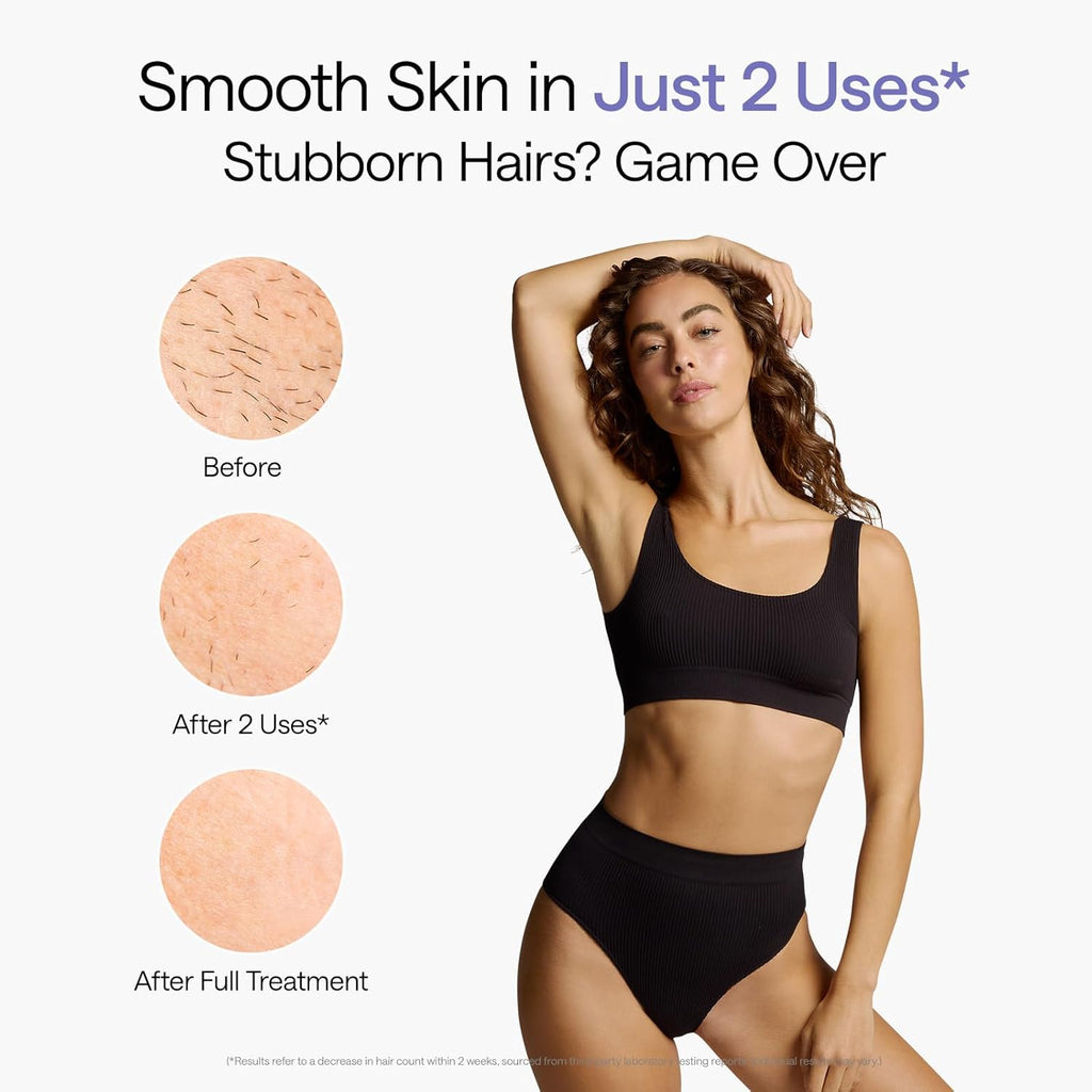 Ulike Air 10 IPL Laser Hair Removal Device