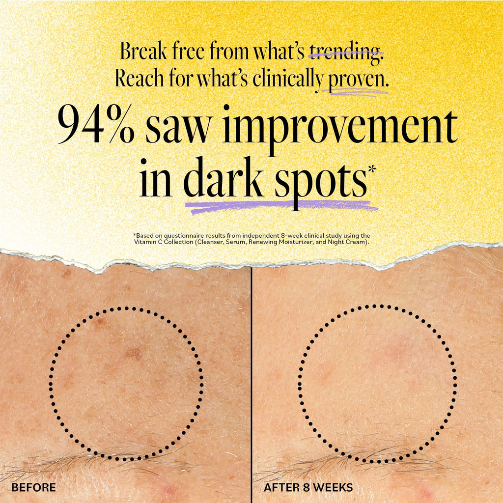 Derma E Vitamin C Renewing Face Moisturizer, 2 Oz, Brightening and Hydrating Facial Skin Renewing Cream, Anti-Aging Wrinkle Cream for Women, Day and Night Moisturizer for Face